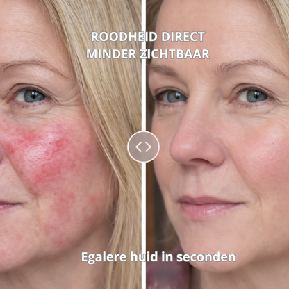 Redness Away Corrector