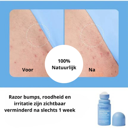 SilkReveal™ - Roll-On tegen ingegroeide haartjes voor een gladde huid