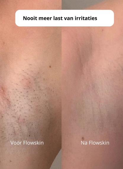 Flowskin™ Trimmer – Zachte huid in 2 minuten – zonder irritatie