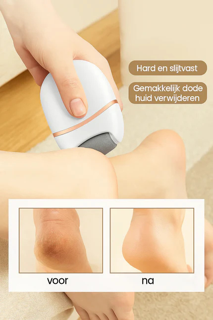 Delicate Touch elektrische eeltverwijderaar