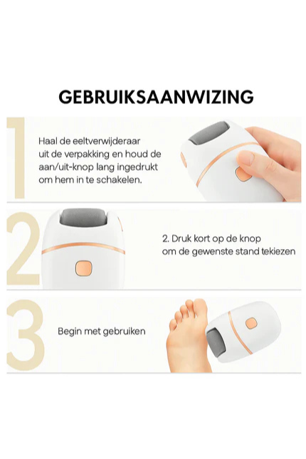 Delicate Touch elektrische eeltverwijderaar