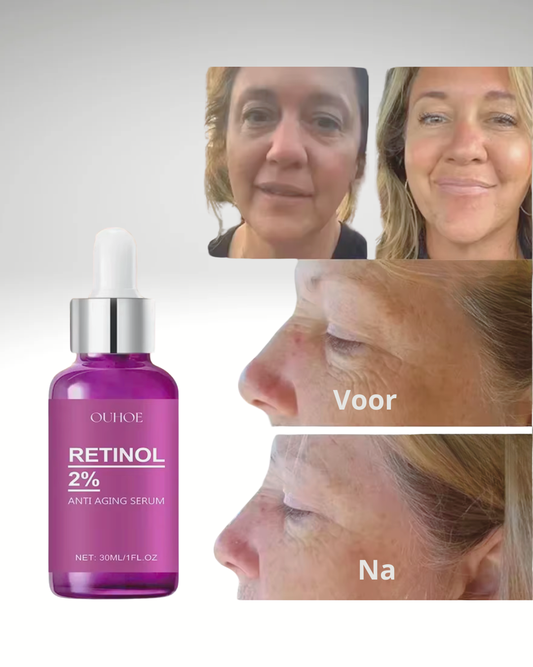 Retinol Serum 2%