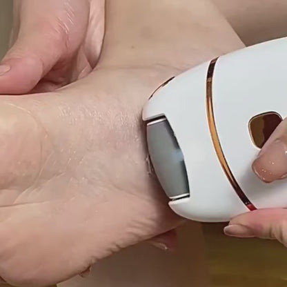 Delicate Touch elektrische eeltverwijderaar