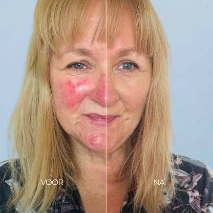 Redness Away Corrector